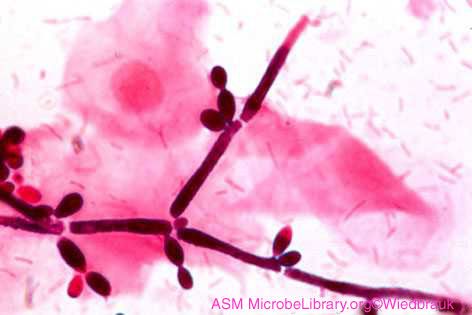 Candida ফুজি (candida) ক্যাথেরিডিয়াস এর জীবাণু