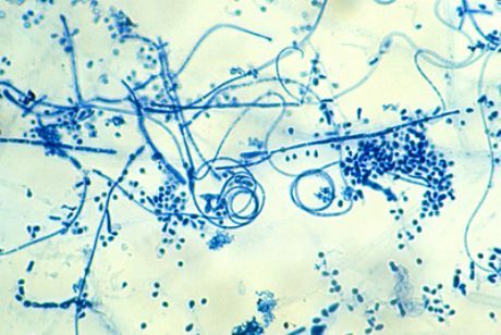 ফুট epidermophytosis এর উদ্দেশ্যপ্রণোদিত এজেন্ট (ট্রাইফোফিলটন আন্তঃডিজিটালে)